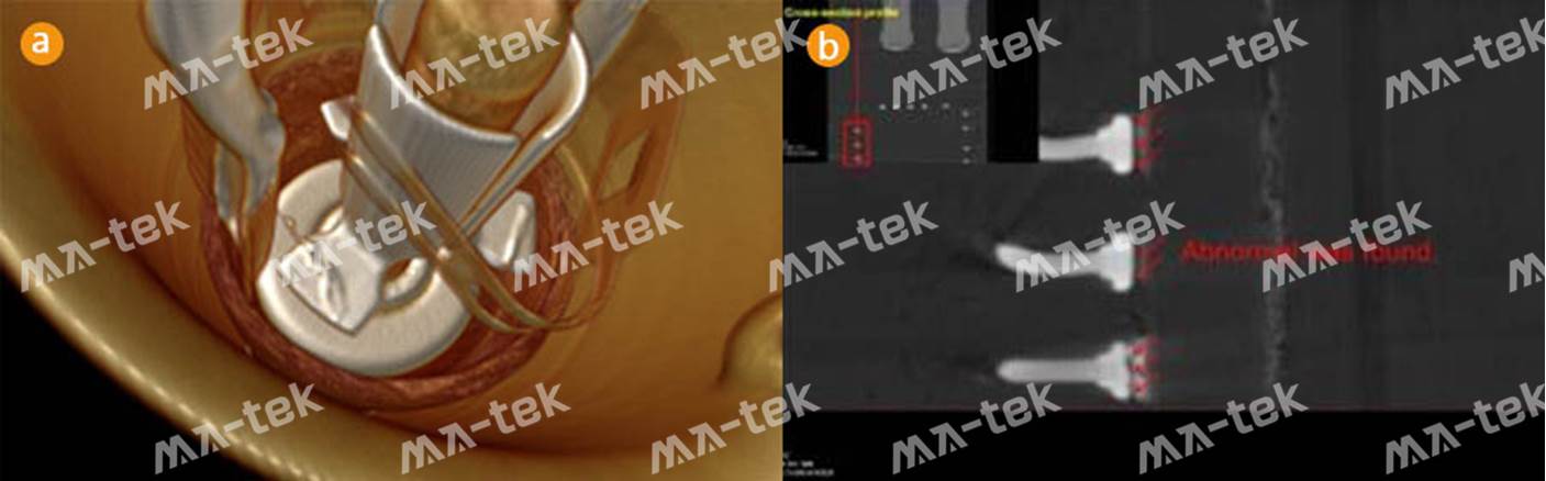 3D-XRAY-8-8 3D-XRAY-8-8